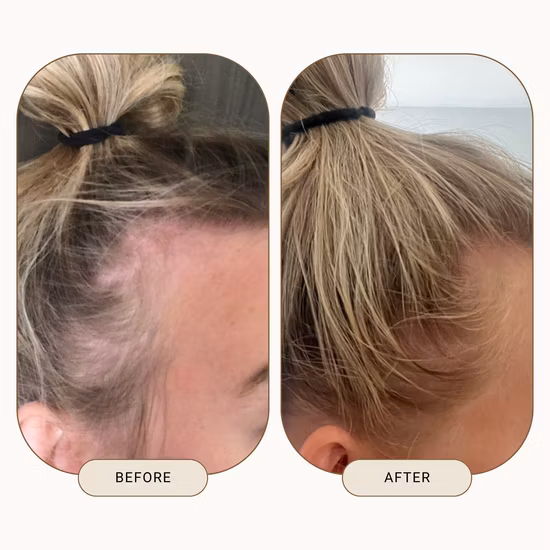 All Natural Organic Repairing Growth Scalp Care Rosmarinöl für das Haarwachstum